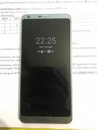 LG  G6